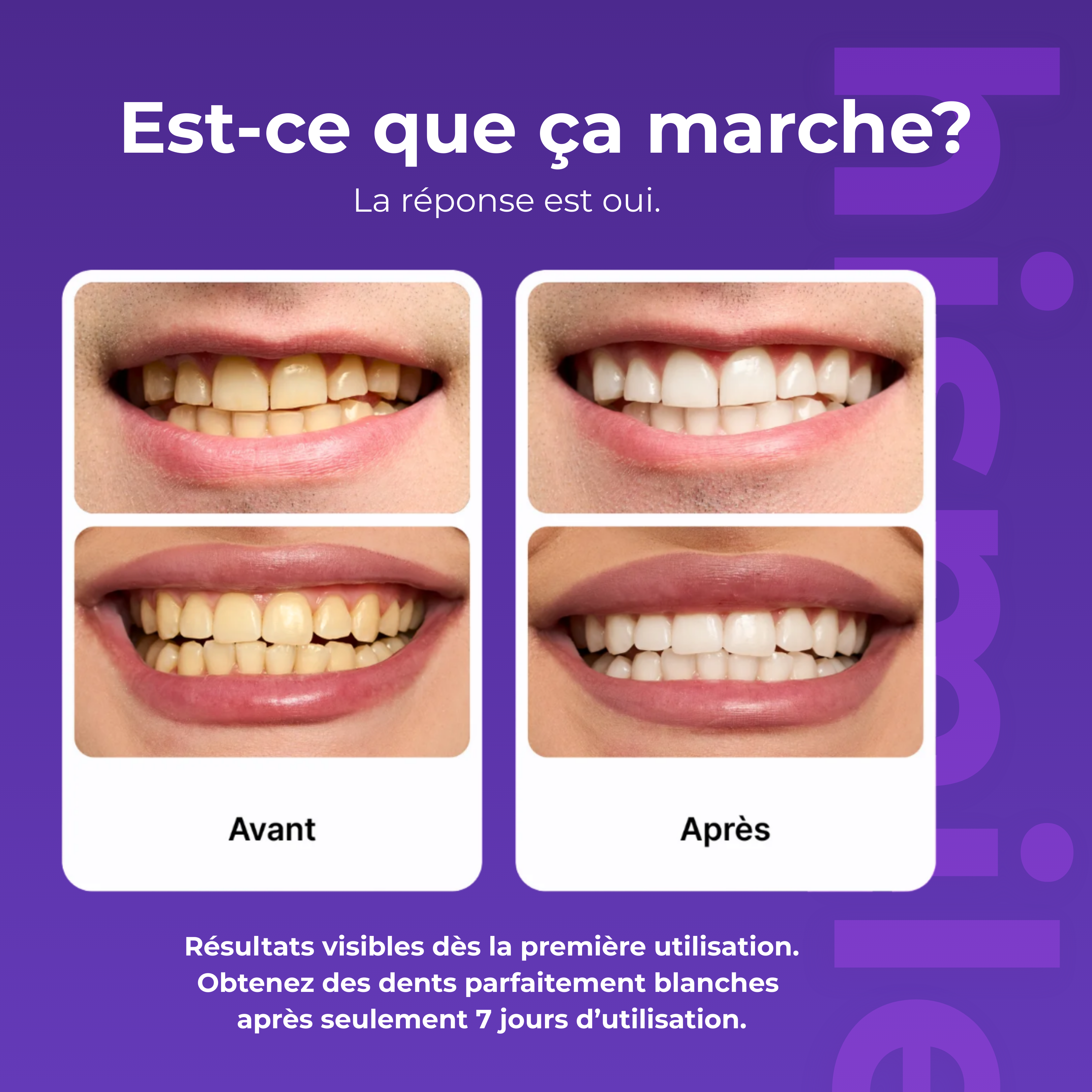 Bandes Blanchiment Dentaire